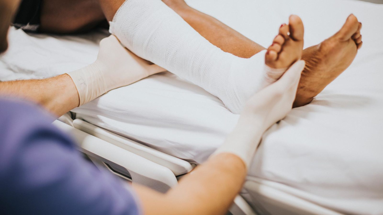 injured leg in a cast